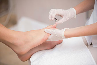 medische pedicure ingegroeide nagels nagelbeugel nagels chiropodiste schimmelnagel diabetische voet oncologische voet eelt wratjes likdoorn